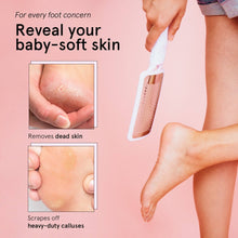 Load image into Gallery viewer, Foot Files Set